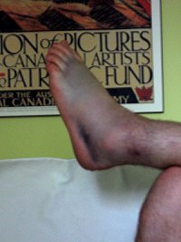 The ankle. Yes it is that colour.