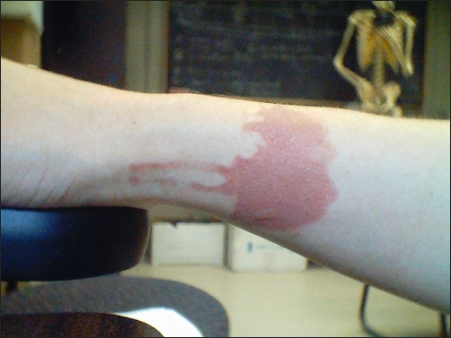 Owwww....this is 3 days old at this point.