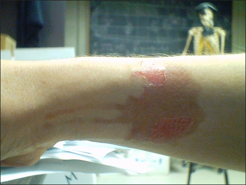 A week later.