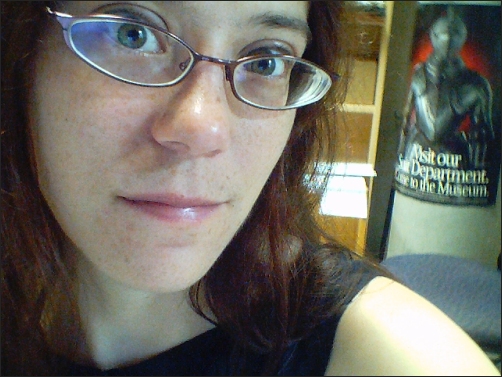 Freckles!